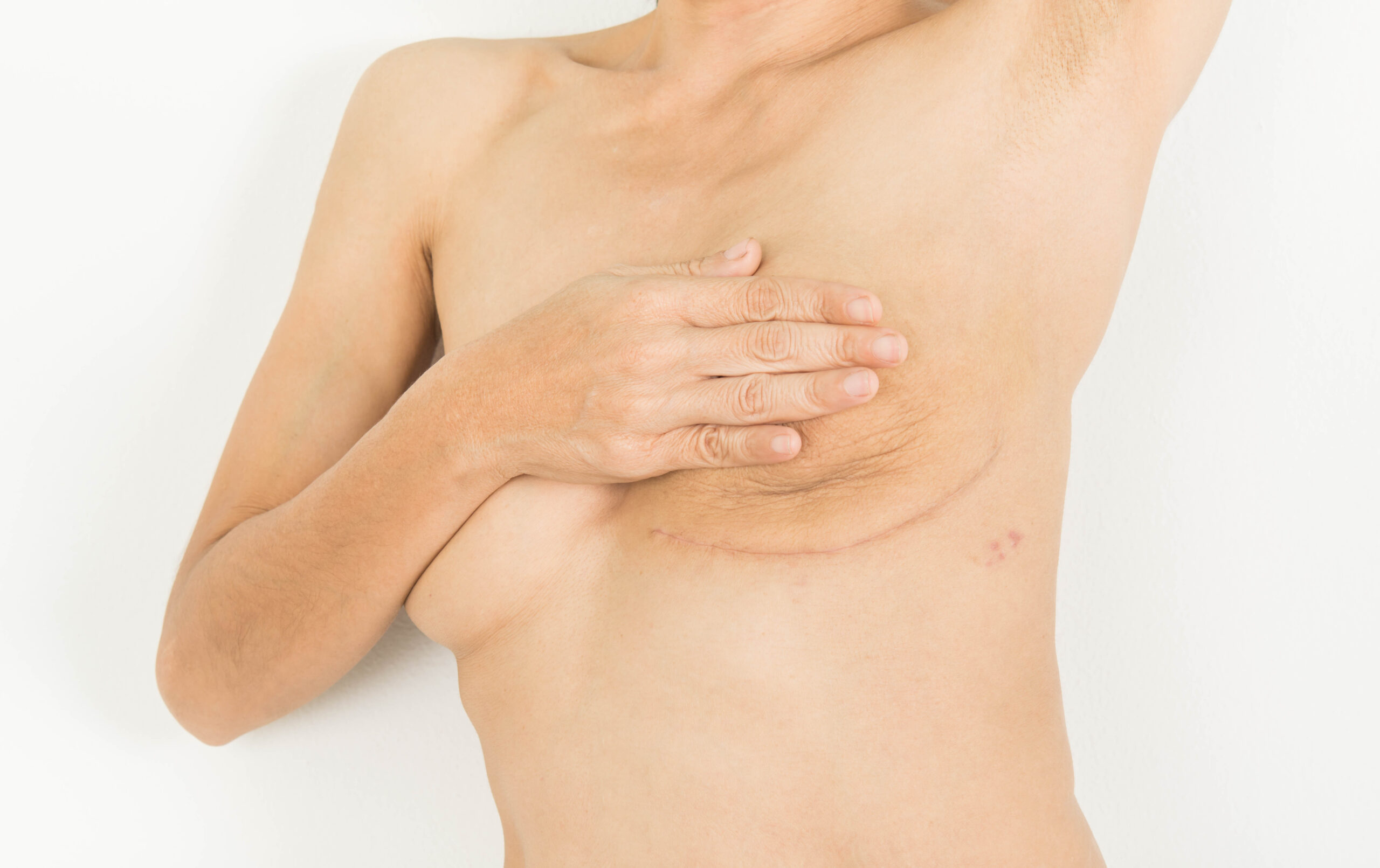 Cancer Rehab & Scar Therapy