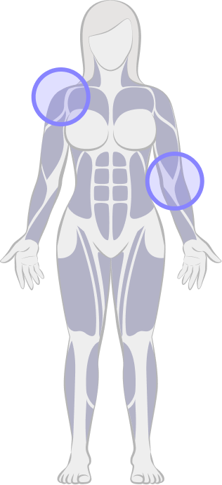 Reach Without Restriction. Targeted Treatment in Kenilworth for Shoulder & Upper Limb Pain.